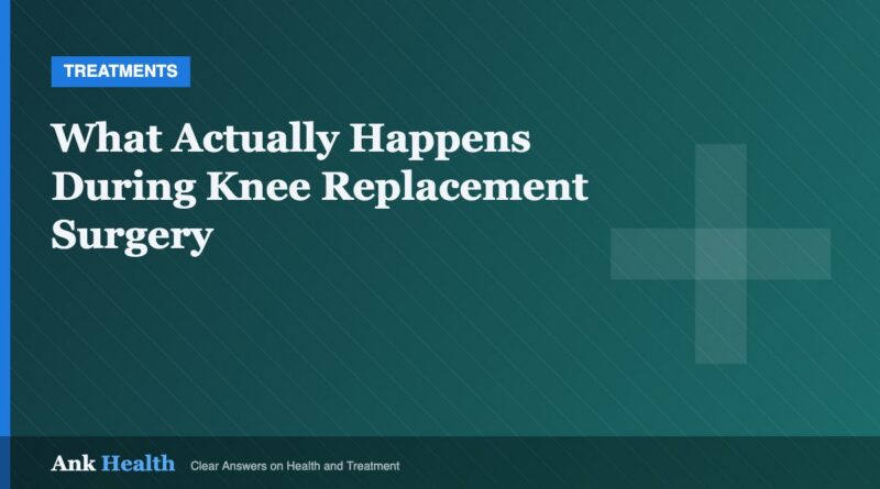 What Actually Happens During Knee Replacement Surgery